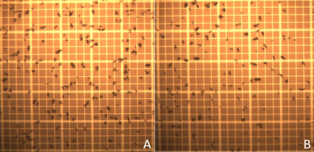 Macroaggregated Albumin