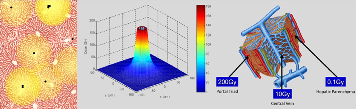 Radiomicrosphere Dosimetry: Principles and Current State of the Art