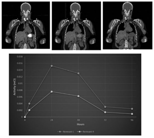 PET/CT in Patients with Differentiated Thyroid Cancer: Clinical and Quantitative Image Analysis